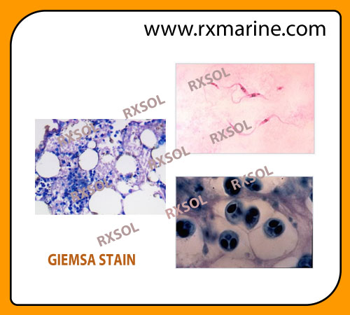 GIEMSA STAIN